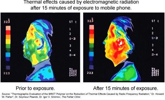 SHUNGITE EMF Pendants : Tree of Life, Flower of Life, Yin-Yang, Donut-Shield, Protection from WiFi, Smart Phones, Laptop, PC